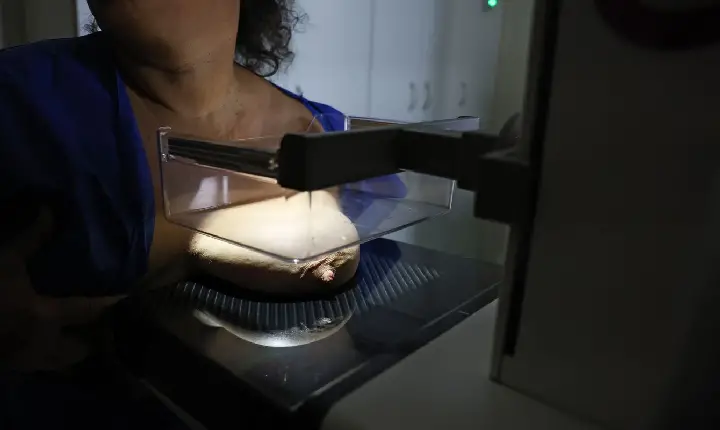 ANS defende que plano cubra mamografia digital sem restrição de idade