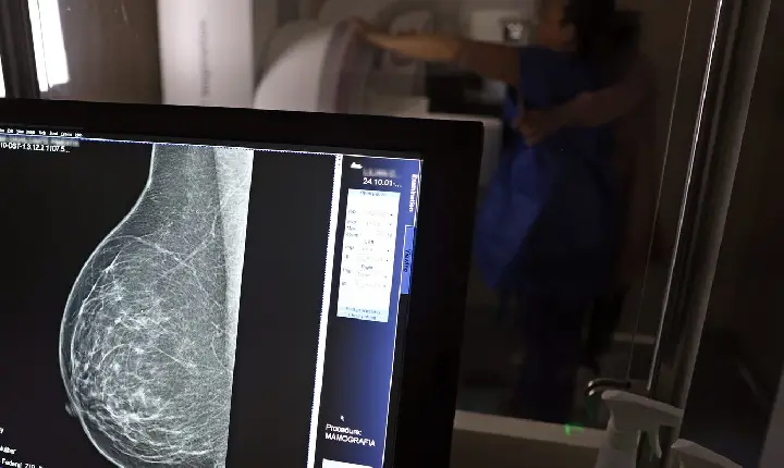 Médicos lançam guia para evitar recusa de mamografia digital