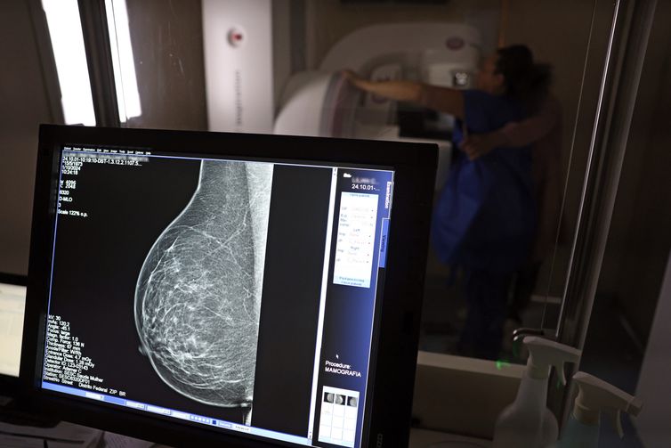 Falta de acesso a mamógrafos limita prevenção do câncer de mama
